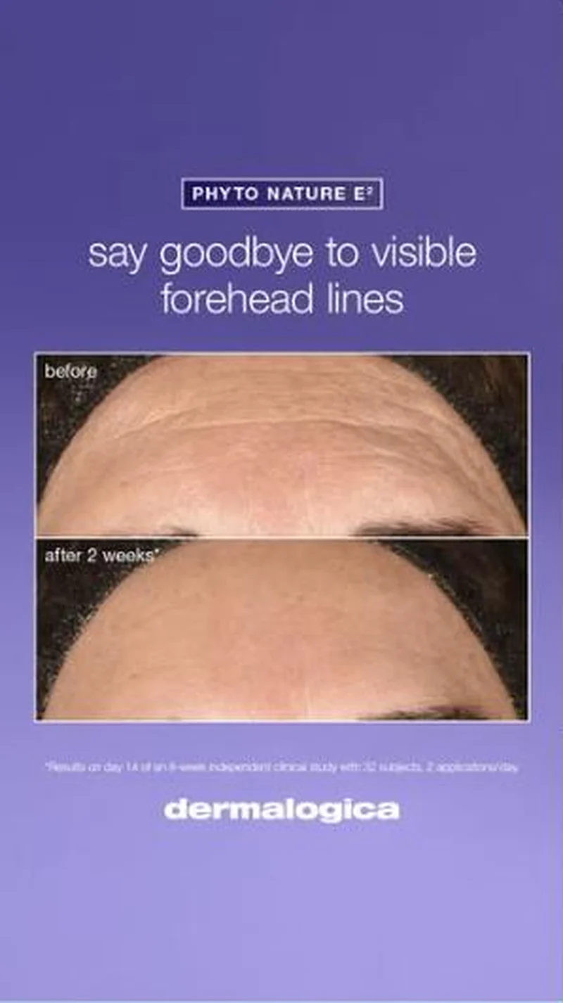Say goodbye to visible forehead lines, 2 week crops